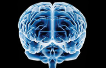Cerebro-2 Cerebro-2