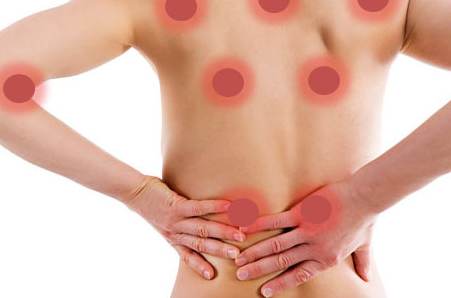 Fibromialgia: la enfermedad invisible