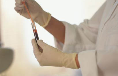 La OMS reconoce que no toda la sangre donada es analizada