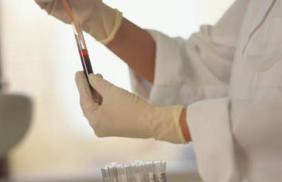 Crean una prueba de sangre permite detectar y controlar el cáncer