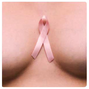 Nueva opción terapéutica para un tipo de cáncer de mama