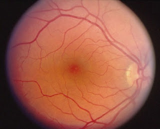 Destacan cambio en la historia del tratamiento de tres graves enfermedades de la retina