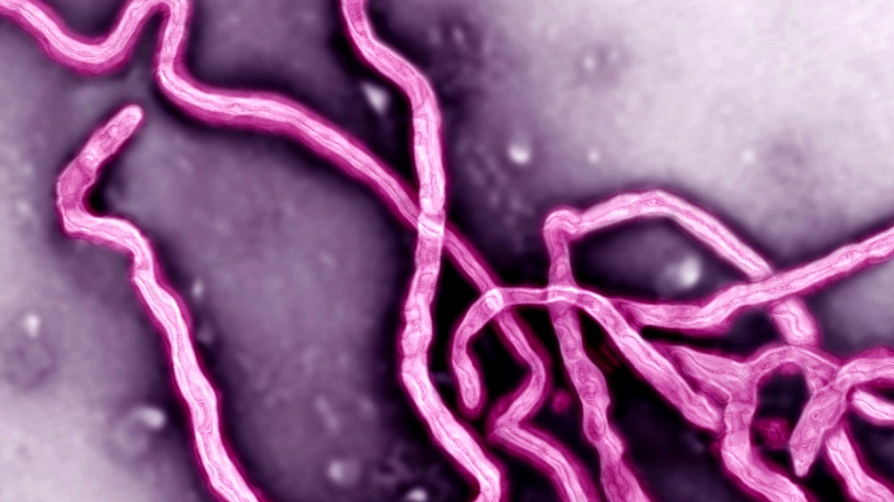 Anunciaron inicio de fase 1 del ensayo clínico de vacuna para el Ébola