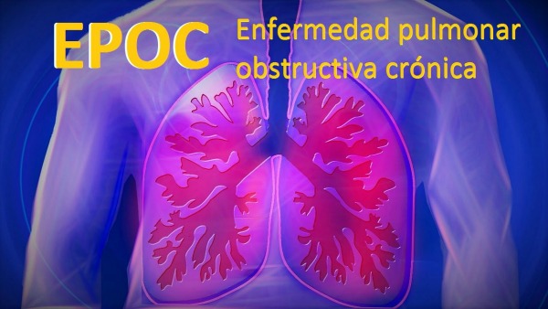 Vacaciones: 5 recomendaciones para pacientes con EPOC