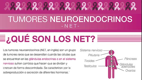 Tumores neuroendocrinos: la urgencia de diagnóstico temprano y tratamiento oportuno