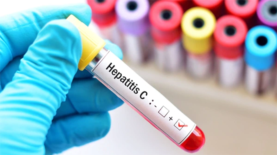 La Hepatitis C comienza a preocupar a otras especialidades médicas