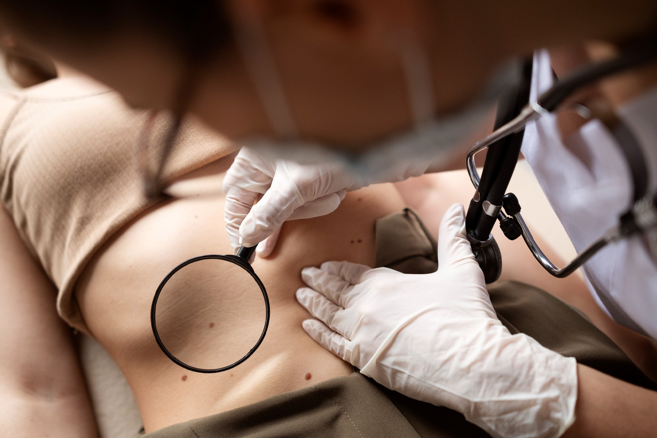 Nuevas tecnologías de detección de melanomas y las claves para protegerse del cáncer de piel