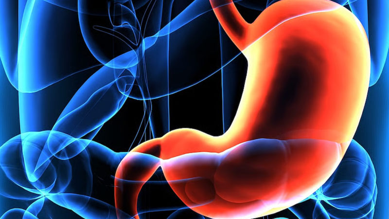 Descubren una inmunoterapia eficaz contra el cáncer de estómago
