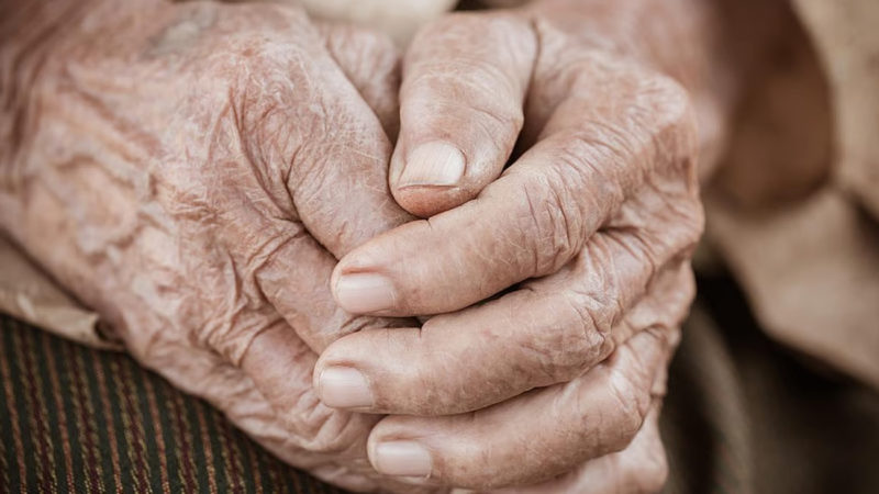 ¿Por qué se forman las arrugas?