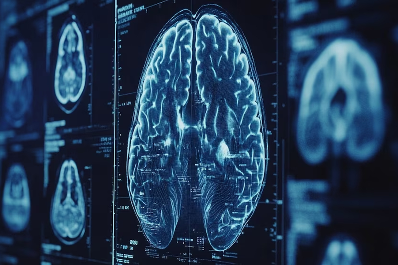 Encuentran un vínculo entre las bacterias de la boca y la enfermedad de Parkinson