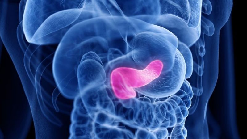 El índice de riesgo ayuda a predecir la recurrencia del cáncer de páncreas