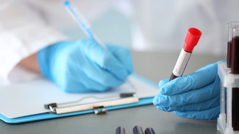 Un análisis de sangre podría anticipar cuándo comenzarán los síntomas del Alzheimer