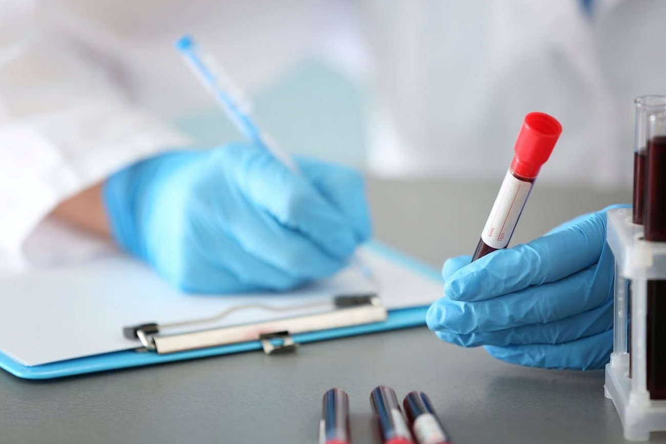 Un análisis de sangre podría anticipar cuándo comenzarán los síntomas del Alzheimer