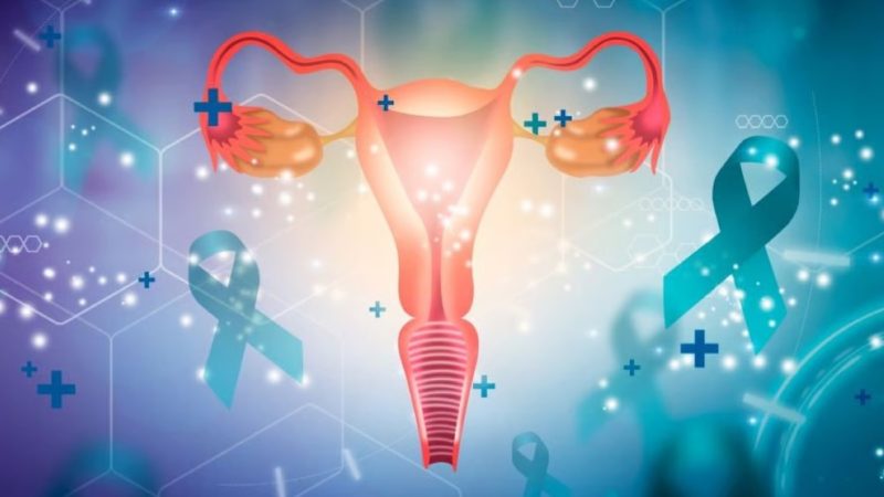 Un “complemento” quirúrgico reduce drásticamente el riesgo de cáncer de ovario