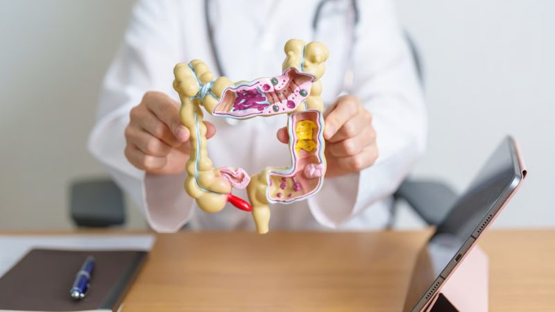 Aumentan las muertes por cáncer de colon en jóvenes sin título universitario