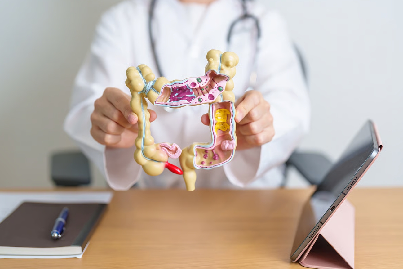 Aumentan las muertes por cáncer de colon en jóvenes sin título universitario