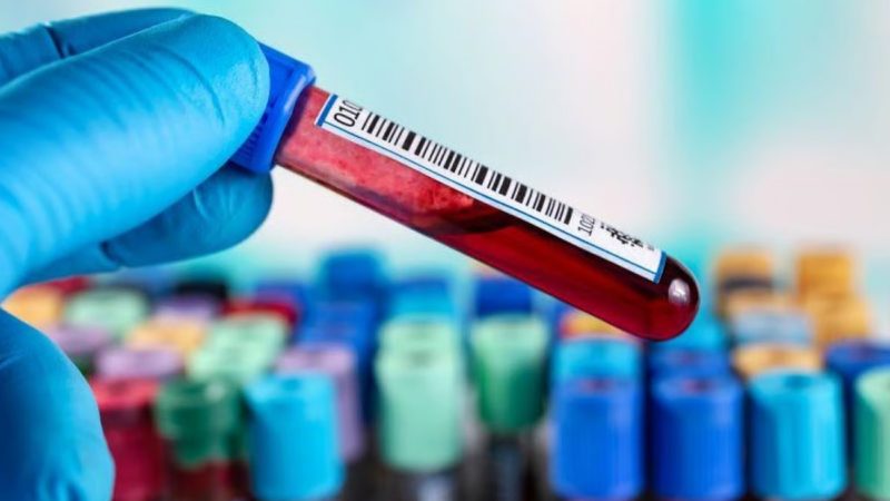 Un nuevo análisis de sangre mejora la detección de los cánceres de próstata más agresivos