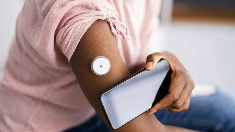 Los monitores continuos de glucosa podrían mejorar el control de la diabetes tipo 2 sin necesidad de insulina